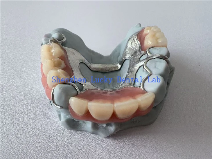 3D εκτύπωσης Horseshoe σε σχήμα μεταλλικού πλαισίου με ακρυλική οδοντοστοιχία κατασκευασμένη στην Κίνα