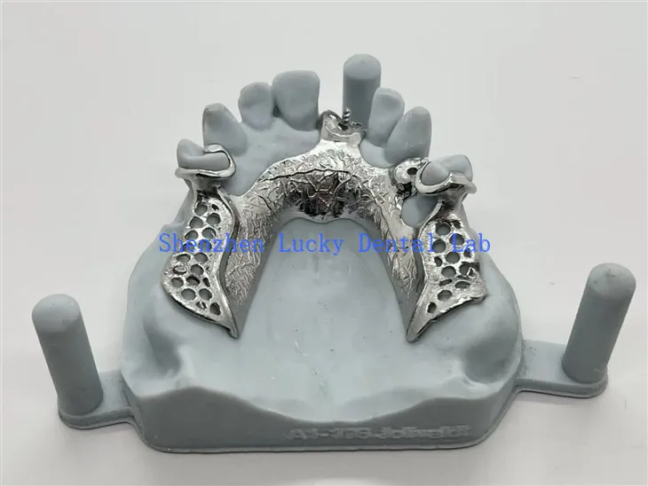 Μερικές προσθέσεις χυτού πλαισίου