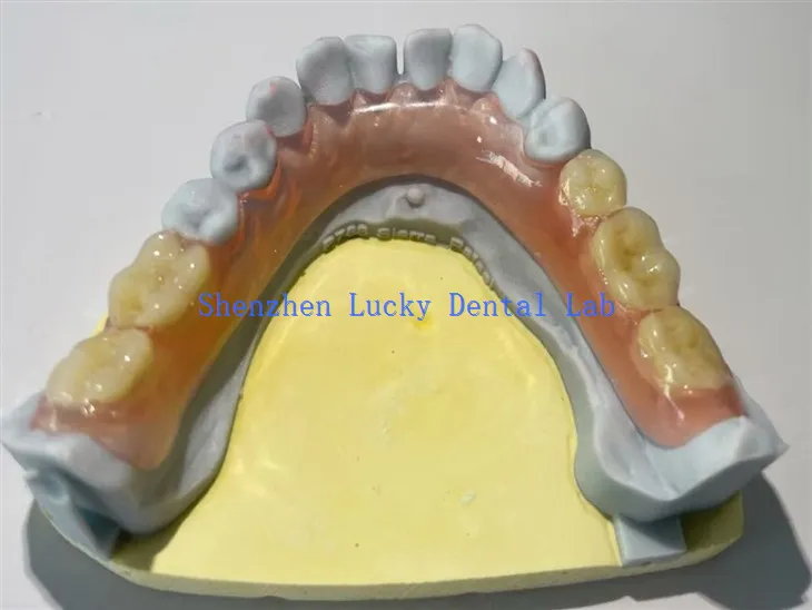 Άνετοι μερικοί ευέλικτοι κατασκευαστές οδοντοστοιχίας