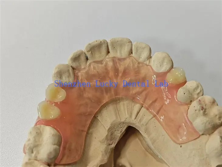 Άνετο εύκαμπτο οδοντιατρικό εργαστήριο οδοντοστοιχίας