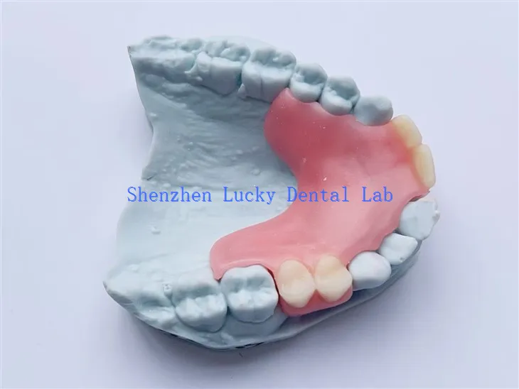 Προσαρμοσμένη οδοντιατρική μερική εύκαμπτη οδοντοστοιχία στους κατασκευαστές