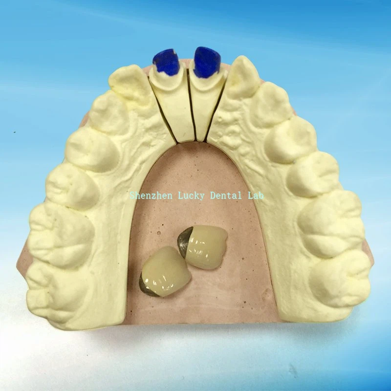 Semi - πολύτιμο μεταλλικό palladium - Silver Crown