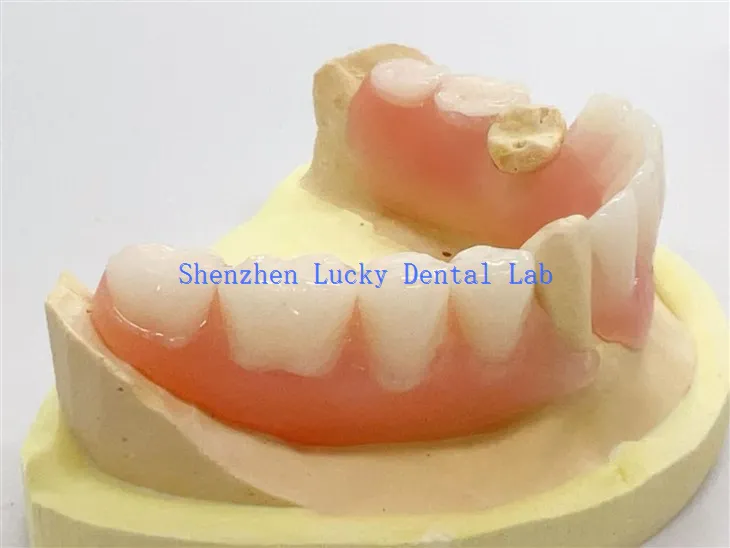 Υψηλής ποιότητας οδοντιατρική μερική ευέλικτη οδοντοστοιχία