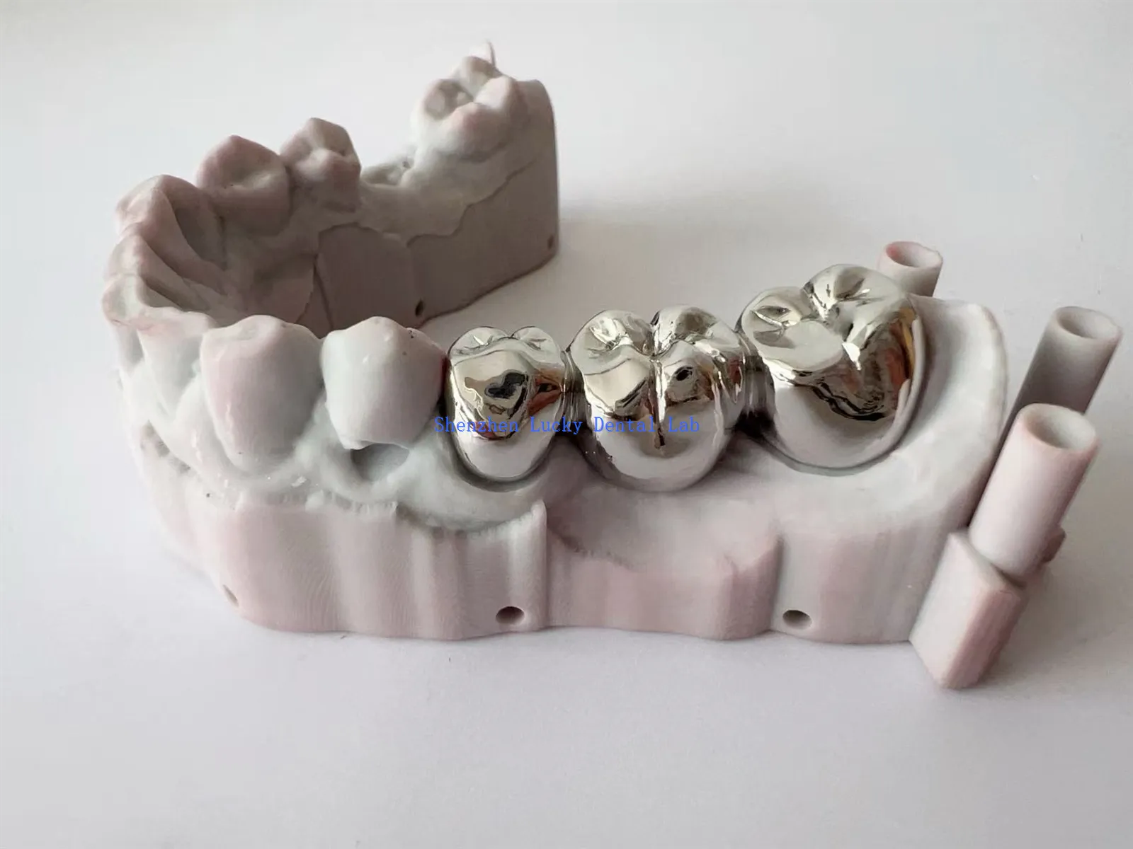 2025-06-11112055383 2025-06-11112055383